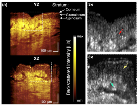 In vivo volumetric imaging by crosstalk-free full-field OCT