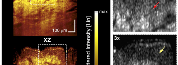 In vivo volumetric imaging by crosstalk-free full-field OCT