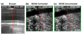 Computational aberration correction in spatiotemporal optical coherence (STOC) imaging