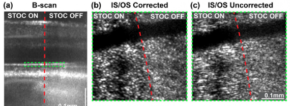 Computational aberration correction in spatiotemporal optical coherence (STOC) imaging
