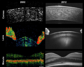 Twenty-five years of optical coherence tomography: the paradigm shift in sensitivity and speed provided by Fourier domain OCT