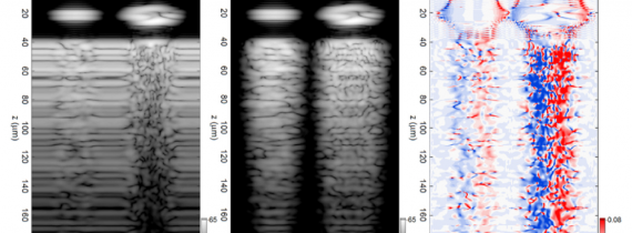 Classification of biological micro-objects using optical coherence tomography: in silico study