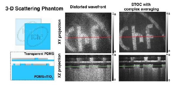 Spatio-Temporal Optical Coherence Imaging–a new tool for in vivo microscopy