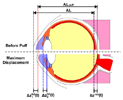 High-speed OCT-based ocular biometer combined with an air-puff system for determination of induced retraction-free eye dynamics