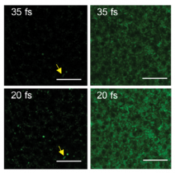 Two-photon imaging of the mammalian retina with ultrafast pulsing laser