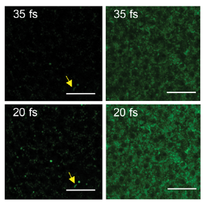 Two-photon imaging of the mammalian retina with ultrafast pulsing laser