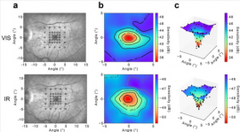 Two-photon microperimetry: sensitivity of human photoreceptors to infrared light