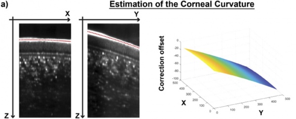 In vivo imaging of the human cornea with high-speed and high-resolution Fourier-domain full-field optical coherence tomography
