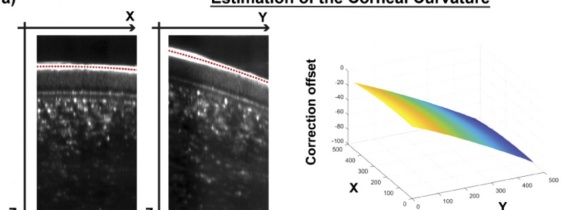 In vivo imaging of the human cornea with high-speed and high-resolution Fourier-domain full-field optical coherence tomography