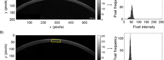 Keratoconus Detection Based on a Single Scheimpflug Image