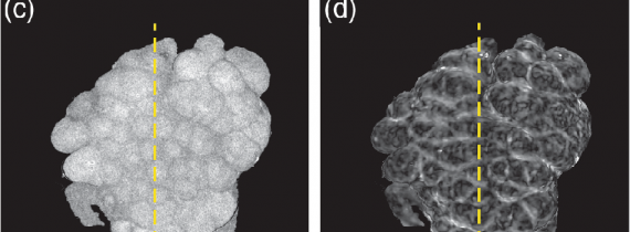 Influence of tissue fixation on depth-resolved birefringence of oral cavity tissue samples