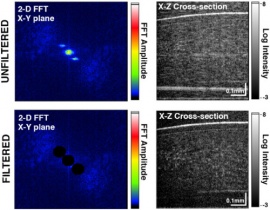Multimode fiber enables control of spatial coherence in Fourier-domain full-field optical coherence tomography for in vivo corneal imaging