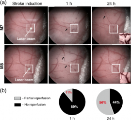 In vivo brain imaging with multimodal optical coherence microscopy in a mouse model of thromboembolic photochemical stroke
