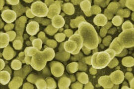 SERSitive: New substrates make it possible to routinely detect one molecule in a million