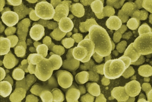 SERSitive: New substrates make it possible to routinely detect one molecule in a million