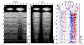 Classification of biological micro-objects using optical coherence tomography: in silico study