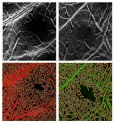 Enhancing microvasculature maps for Optical Coherence Tomography Angiography (OCT-A)