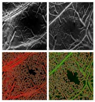Enhancing microvasculature maps for Optical Coherence Tomography Angiography (OCT-A)