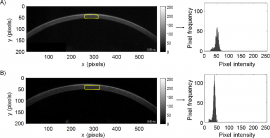 Keratoconus Detection Based on a Single Scheimpflug Image
