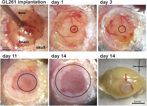 Longitudinal in-vivo OCM imaging of glioblastoma development in the mouse brain