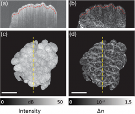Influence of tissue fixation on depth-resolved birefringence of oral cavity tissue samples