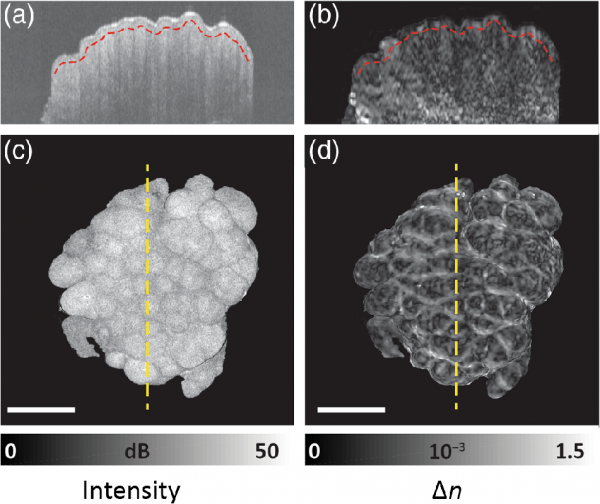 Influence of tissue fixation on depth-resolved birefringence of oral cavity tissue samples