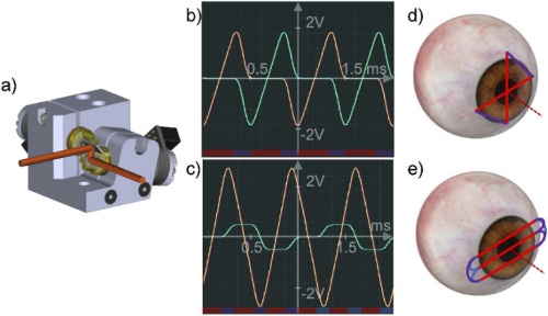 Multi-meridian corneal imaging of air-puff induced deformation for improved detection of biomechanical abnormalities