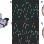 Multi-meridian corneal imaging of air-puff induced deformation for improved detection of biomechanical abnormalities